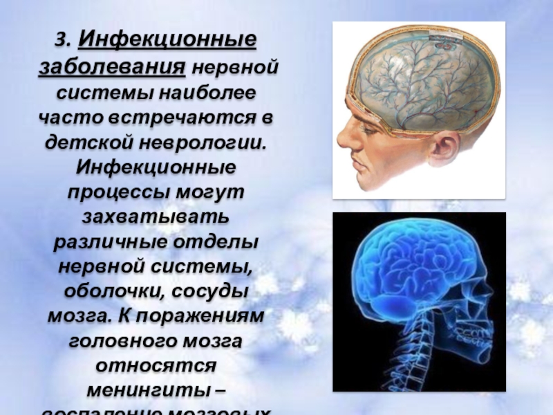 Заболевания мозга диагностика. Заболевания нервной системы. Заюолнваниянервной системы. Инфекционные заболевания нервной системы. Поражение головного мозга.