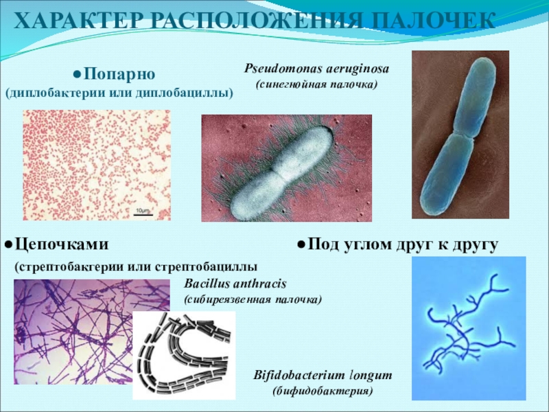 Бактерия синегнойная палочка. Бациллы диплобациллы. Pseudomonas aeruginosa микробиология. Палочковидные бактерии диплобактерии. Палочки бактерии микробиология.