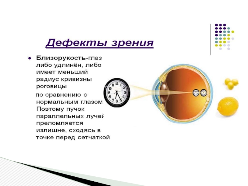 Структура дефекта при нарушении слуха схема