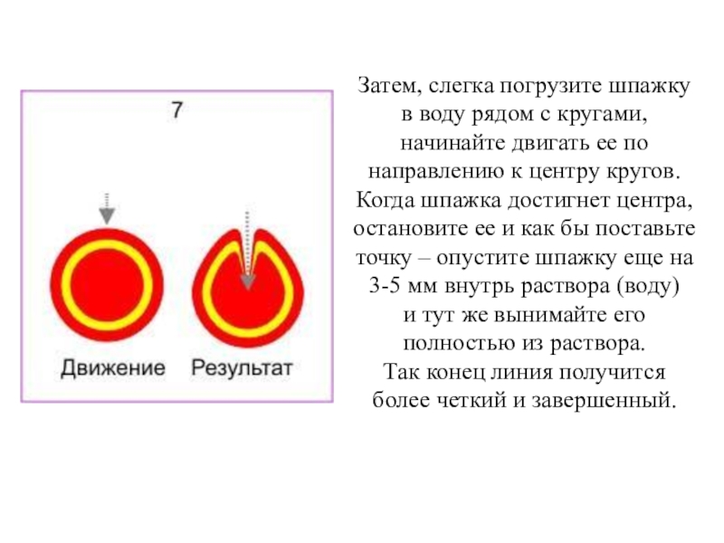 Корнилова папилломы схема