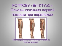 Презентация по ОБЖ на тему: Основы оказания первой помощи при переломах