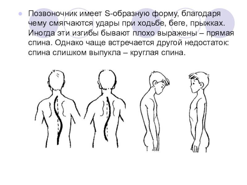 S образный позвоночник. S образная форма позвоночника. Позвоночник s образной формы. Позвоночник имеет s образную форму. С образный позвоночник зачем.