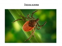 Презентация по профилактике здоровья на тему Укусы клеща