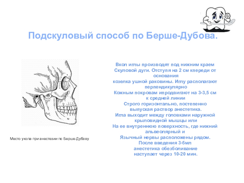 Анестезия по берше. Подскуловой метод ( по Берше-дубову). Стволовая анестезия по Берше-дубову-Уварову. Методы мандибулярной анестезии по Берше. Мандибулярная анестезия методика.