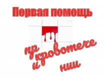 Презентация по теме: Кровотечение для СПО