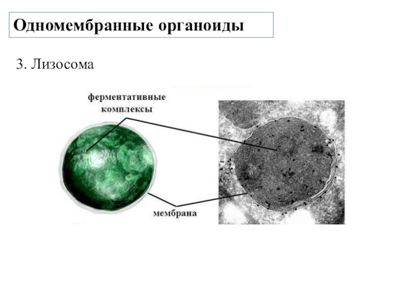 Органоид лизосома рисунок. Лизосомы строение рисунок. Лизосомы строение в микроскопе. Микроскопическое строение лизосомы. Строение лизосомы рисунок с подписями.