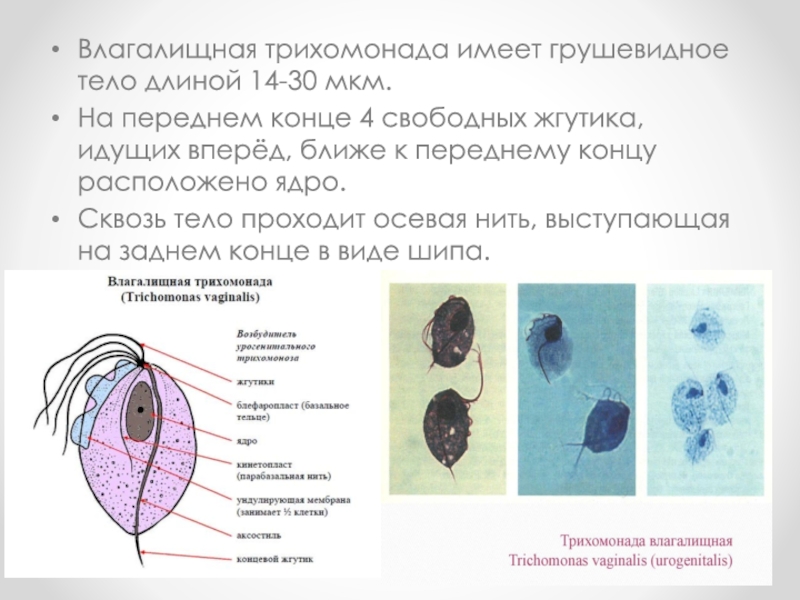 Трихомонада рисунок с подписями