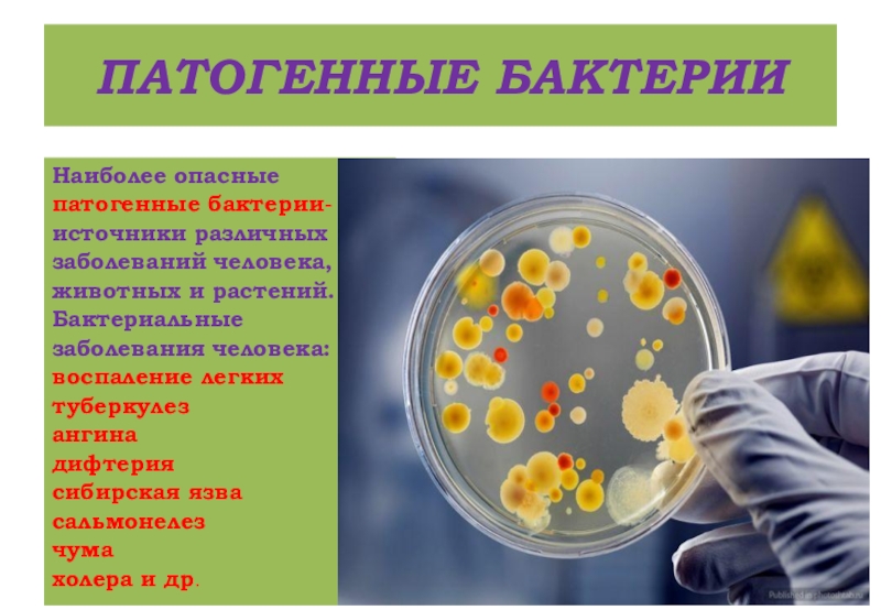 Плюсы бактерий в жизни человека. Патогенные бактерии. Патогенные микроорганизмы. Презентация на тему бактерии в жизни человека. Условно патогенные бактерии.