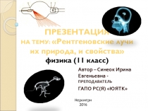 Презентация по Физике на тему Рентгеновские лучи, их свойства (11класс)