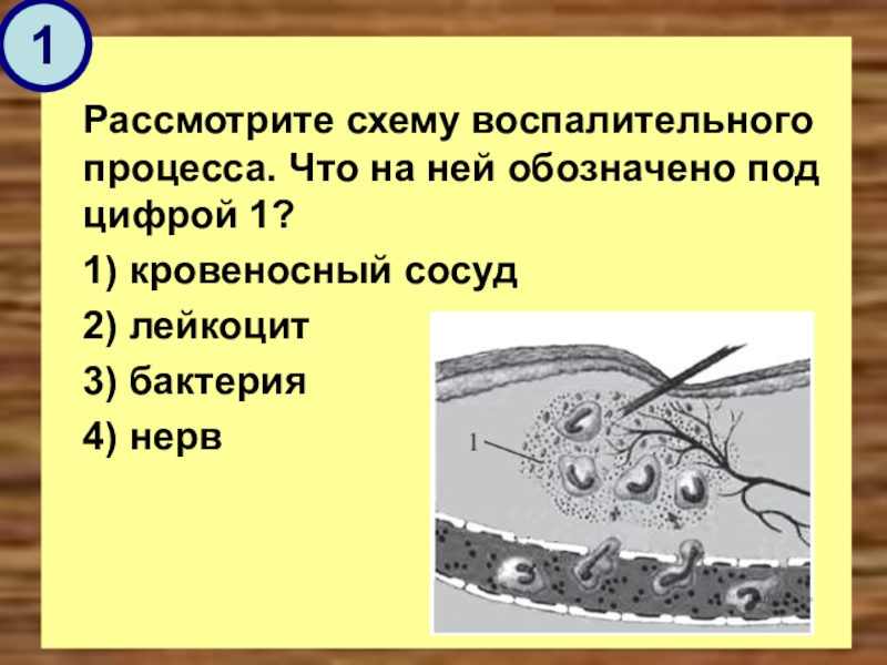 Что обозначено под цифрами. Рассмотрите схему воспалительного процесса.. Рассмотрите схему воспалительного процесса что на ней. Рассмотрите схему воспалительного процесса. Бактерии лейкоциты. Рассмотрите схему воспалительного процесса что обозначено.