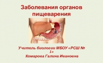 Презентация к открытому уроку в 8 классе на тему Заболевания органов пищеварения