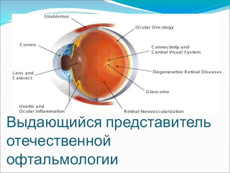 Презентация история офтальмологии