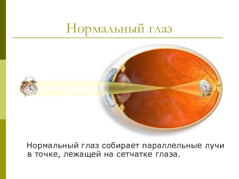 Глаз как оптическая система дефекты зрения и способы их исправления 8 класс презентация