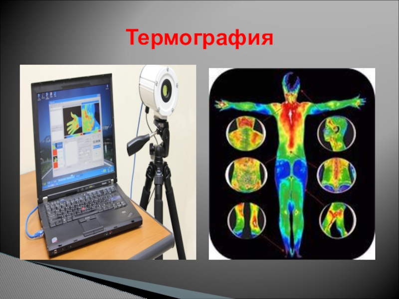 Медицинская термография презентация