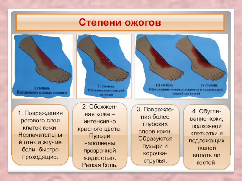 Презентация по биологии 8 класс болезни и травмы кожи