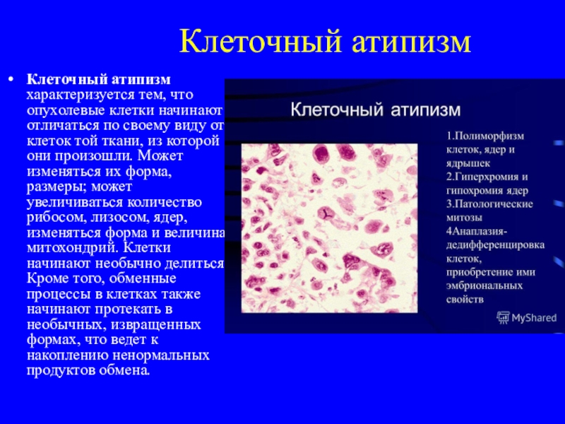 Клетки с гиперхромными ядрами. Клеточный атипизм проявления. Клеточный атипизм в опухолях. Клеточный атипизм характеризуется.