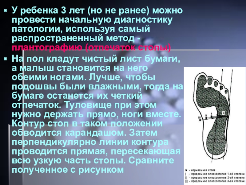 Степени плоскостопия. Продольное плоскостопие степени. Продольное плоскостопие 2 степени. Плоскостопие по степеням. Продольное плоскостопие 3 степени.