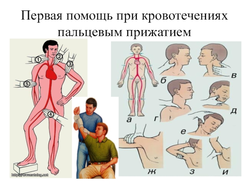 Кровотечения и первая помощь презентация