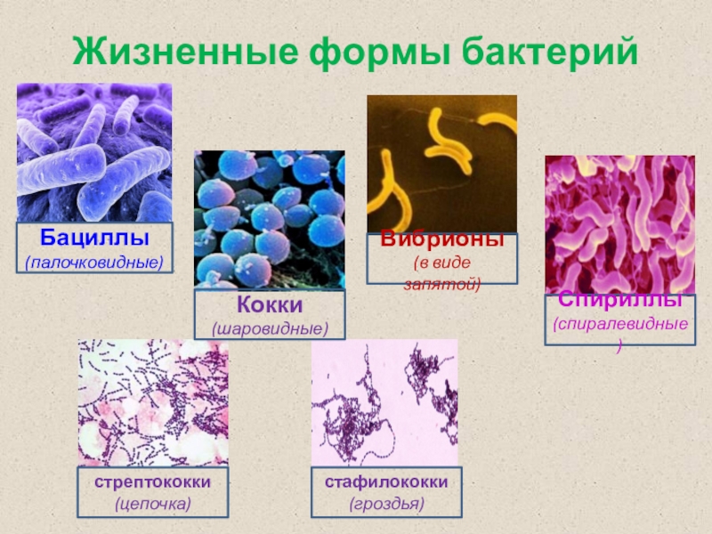 Живые бактерии название. Формы бактерий кокки бациллы вибрионы. Бактерии шаровидной формы кокки.