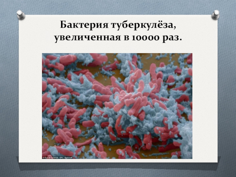 Туберкулез 5 класс. Бактерии в природе. Роль бактерий. Жизнь бактерий.
