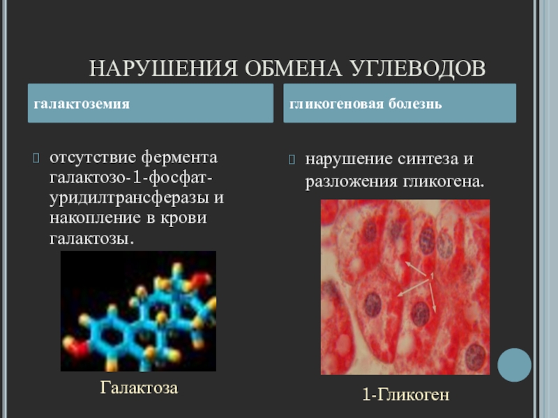 Нарушение углеводного обмена картинки