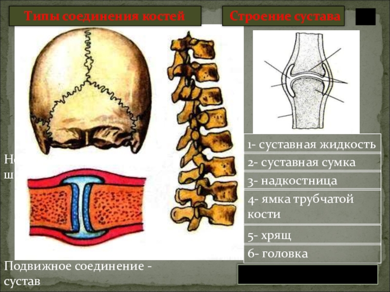 Составьте схему иллюстрирующую виды соединений костей