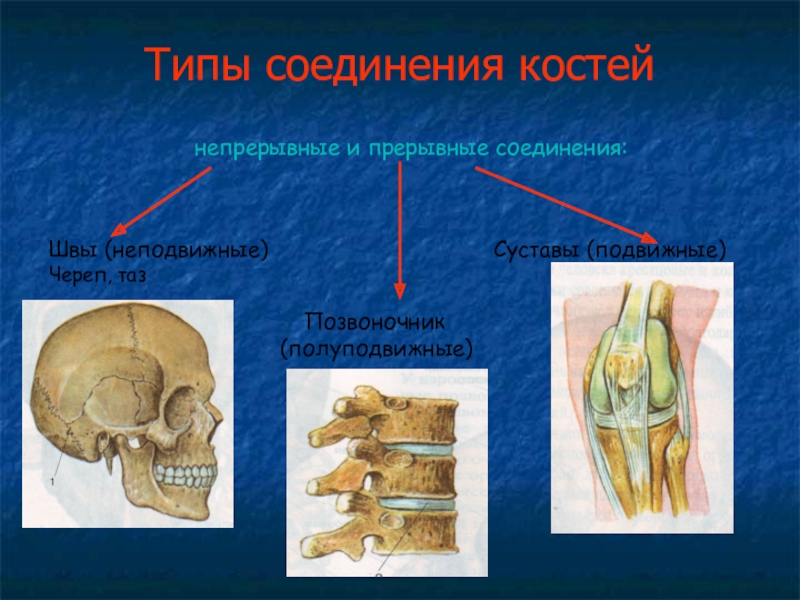 Прерывное соединение кости. Прерывные и непрерывные соединения костей. Соединения костей непрерывные полупрерывные прерывные. Суставы подвижные неподвижные и полуподвижные. Типы соединения костей непрерывные прерывные.