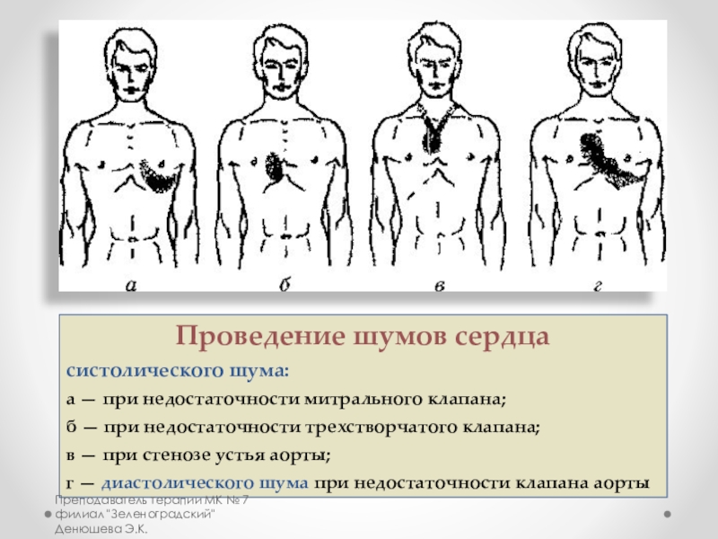 Шумы сердца пропедевтика презентация