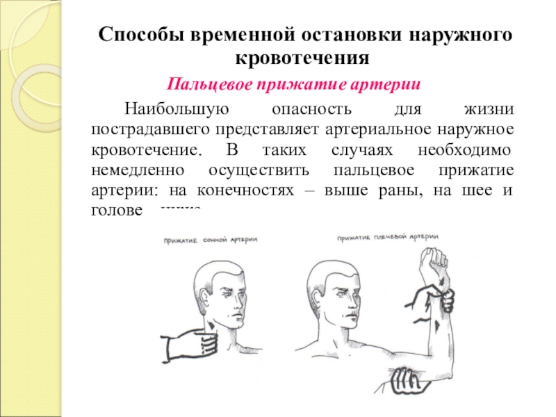 Способы временной остановки наружных. Способы временной остановки наружного кровотечения. Способ временной остановки кровотечения пальцевое прижатие артерий. Способы остановки наружного кровотечения пальцевое прижатие. Способы временной остановки кровотечения из сонной артерии.