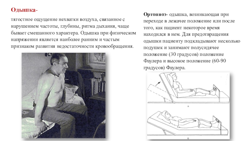 Свисты при выдохе в лежачем положении. Положение пациента при одышке. Положение больного при одышке. Ритм дыхания при одышке.