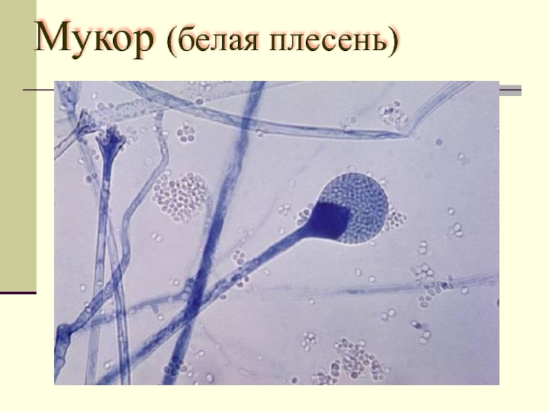 Строение мукора под микроскопом