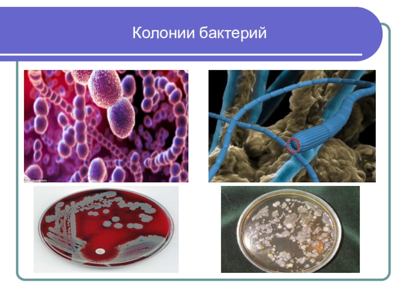 Колонии бактерий. Структура колоний бактерий. Колония микроорганизмов это. Колониальные бактерии. Структура колоний микроорганизмов.