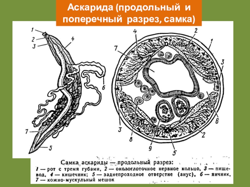 Поперечный разрез. Аскарида в разрезе. Половая система аскариды в поперечном разрезе. Поперечный разрез моря. Аскарида в свинье в разрезе.