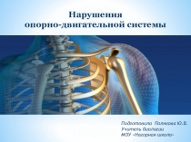 Презентация по биологии на тему Нарушения опорно-двигательной системы (8 класс)