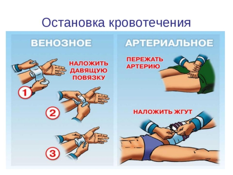 Презентация по обж первая помощь при кровотечениях