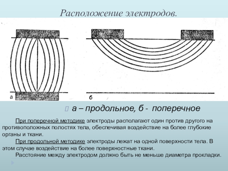 Правильное наложение электродов монитора