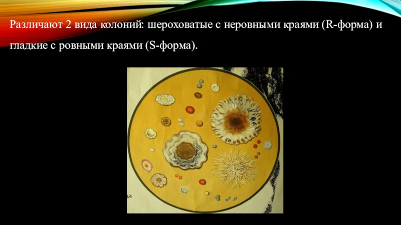 Формы колоний. R S колонии бактерий. R И S формы колоний бактерий. R форма колоний. S форма колоний.