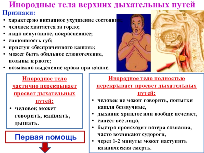 Первая помощь при отсутствии кровообращения презентация