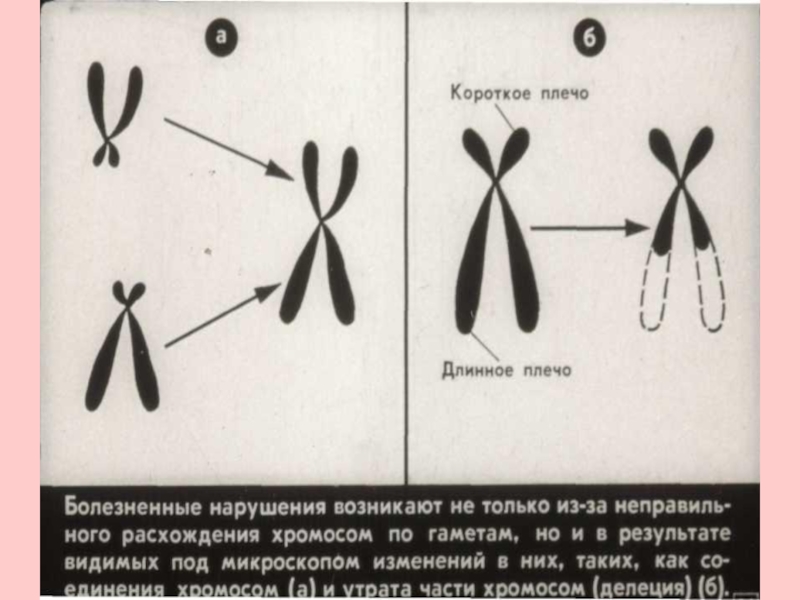 Длина короткого плеча. Делеция длинного плеча х хромосомы. Короткое плечо хромосомы. Делеция короткого плеча 5 хромосомы. Делеция короткого плеча 6 хромосомы.