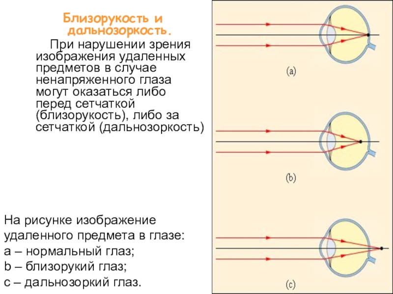 Резкое изображение предмета в нормальном глазе создается