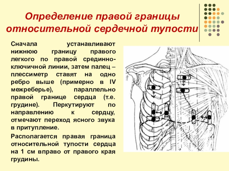 Определение сердечной тупости. Границы относительной сердечной тупости в норме. Определение относительных границ сердца. Методика определения относительной сердечной тупости. Методика определения границ относительной сердечной тупости.