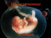 Презентация к уроку биологии Наследственные болезни человека (9 класс)
