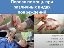 Презентация к уроку ОБЖ, 5 класс, Первая помощь при различных видах повреждений