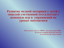 Развитие мелкой моторики у детей с умственной отсталостью.
