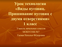 Презентация к уроку технологии на тему Виды пуговиц