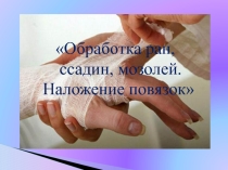 Презентация к уроку 7 касс СБО Наложение повязок