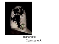 Фобии