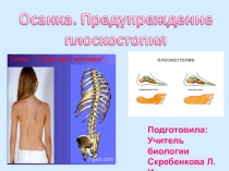 Осанка и Плоскотопие ( 8 класс)