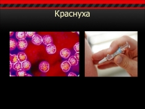 Презентация по Биологии на тему Вирусы. Краснуха