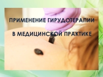 Гирудотерапия